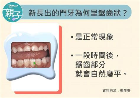 6歲出大牙|【兒童換牙】小朋友幾歲出牙換牙？ 一文看清兒童換。